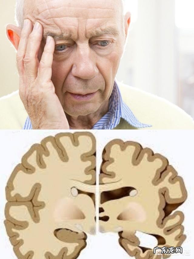 帕金森患者应怎样加强饮食营养