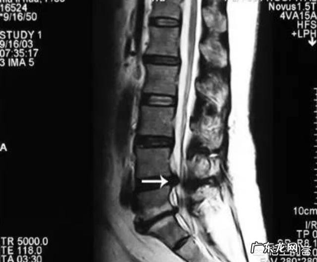 日本的相扑比赛是项什么运动,为何赛手都很胖?