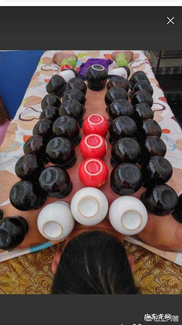 拔火罐真的能祛除身体湿气吗？你会去拔火罐吗？