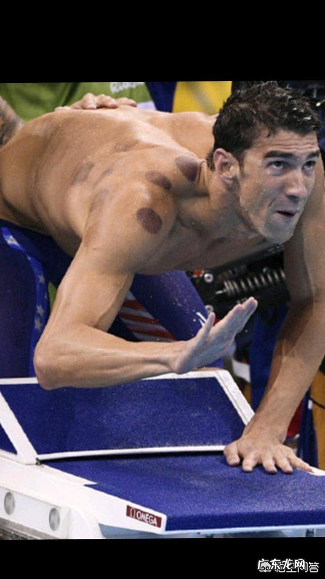 拔火罐真的能祛除身体湿气吗？你会去拔火罐吗？