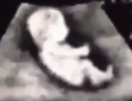 刚怀孕应该马上停掉水乳护肤吗冬天脸干擦什么呢