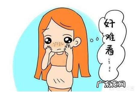 妊娠纹一般产后多久会消失?