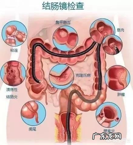 脂肪瘤是怎么长出来的，它会变成癌症吗？