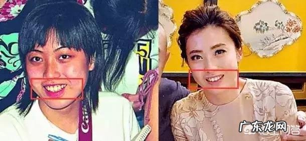 吴昕是第几季录的明星大侦探 吴昕在《明星大侦探》中的表现让你觉得意外吗?