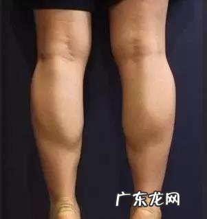 小腿粗怎么能减掉 小腿太粗,怎么能快速剪掉?每天按摩有用吗?