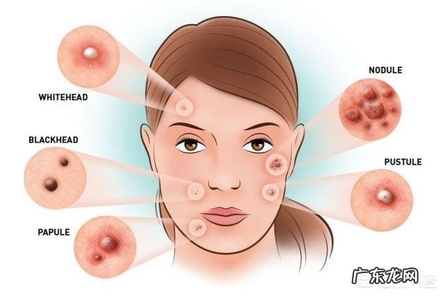 什么样的产品可以让皮肤变滋润？有什么推荐呢？