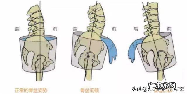 哪里都不胖就是肚子大怎么办?