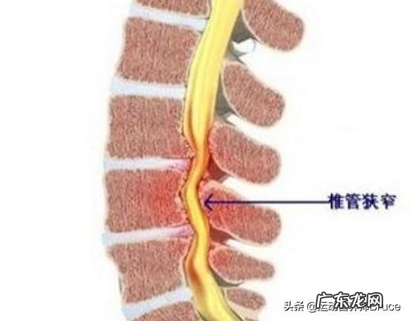 拉伸如何不伤腰椎 站立式的拉伸会损伤腰椎吗?