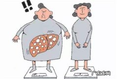 脂肪肝跑步能降下来吗 脂肪肝跑步有用吗