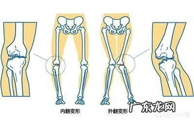 孩子在幼儿园过于肥胖怎么办可以给孩子减肥吗怎么合理健康的减肥