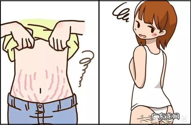 怀孕期间有妊娠纹等生完孩子还会有吗？