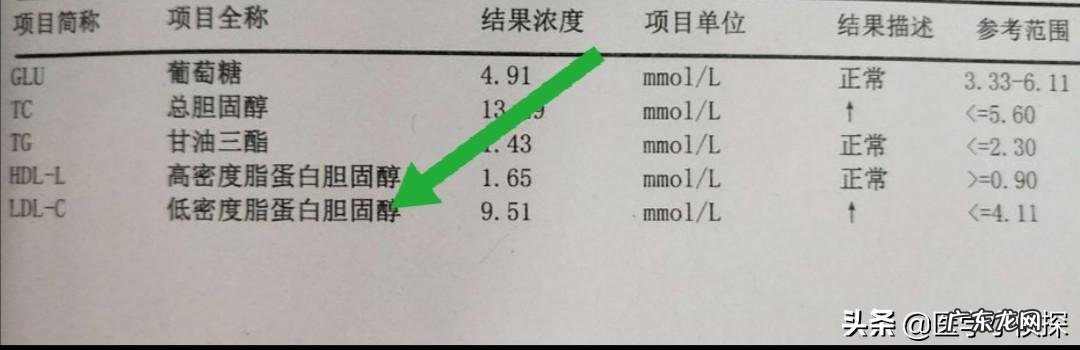 高血压能喝酒吗？少量喝对身体有什么影响？