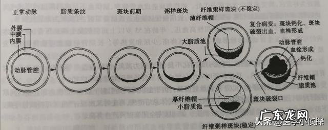 高血压能喝酒吗？少量喝对身体有什么影响？