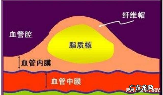 高血压能喝酒吗？少量喝对身体有什么影响？