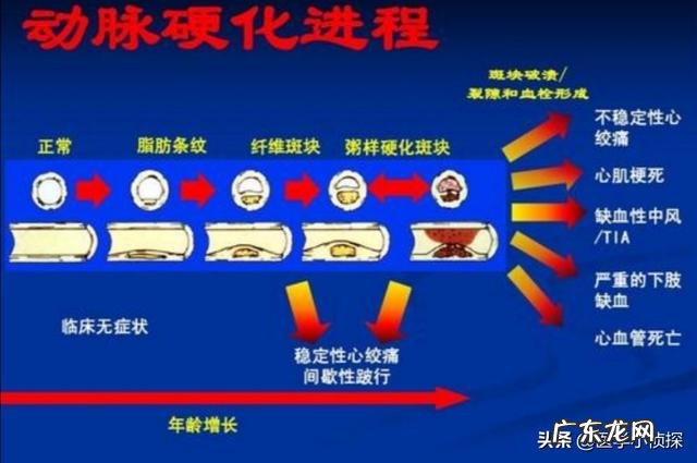 高血压能喝酒吗？少量喝对身体有什么影响？