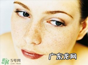 孕斑能用什么方法去除 孕斑怎么去