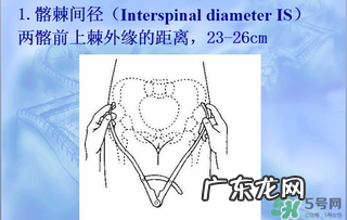 盆骨多大适合顺产 盆骨多大可以顺产