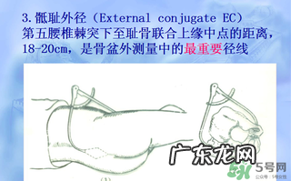 盆骨多大适合顺产 盆骨多大可以顺产