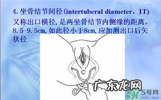 盆骨多大适合顺产 盆骨多大可以顺产