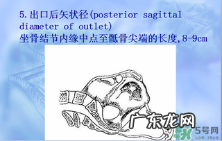 盆骨多大适合顺产 盆骨多大可以顺产