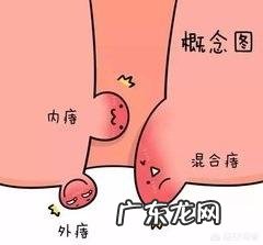 痔疮是怎么形成的得了痔疮后如果不zhi疗的话,会怎样呢