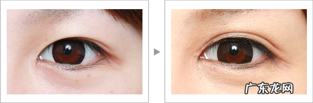 如何按摩眼睛变大 眼头切开风按摩