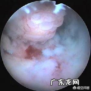 例假时间突然延长是怎么回事?