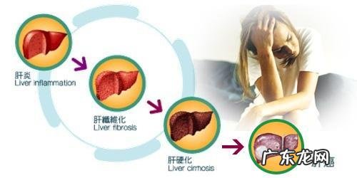 肝硬化失代偿期找什么工作 肝硬化不好找工作怎么办，重活又做不了，医药费每月要好多钱？