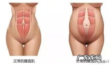 女人在生完孩子后还能瘦回去吗?怎样可以减掉大肚腩?