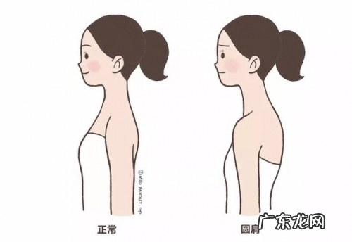圆肩驼背怎么矫正 教你如何矫正圆肩驼背