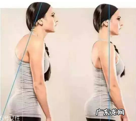 圆肩驼背怎么矫正 教你如何矫正圆肩驼背
