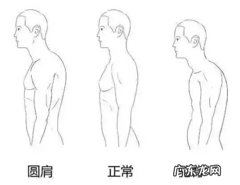 圆肩驼背怎么矫正 教你如何矫正圆肩驼背