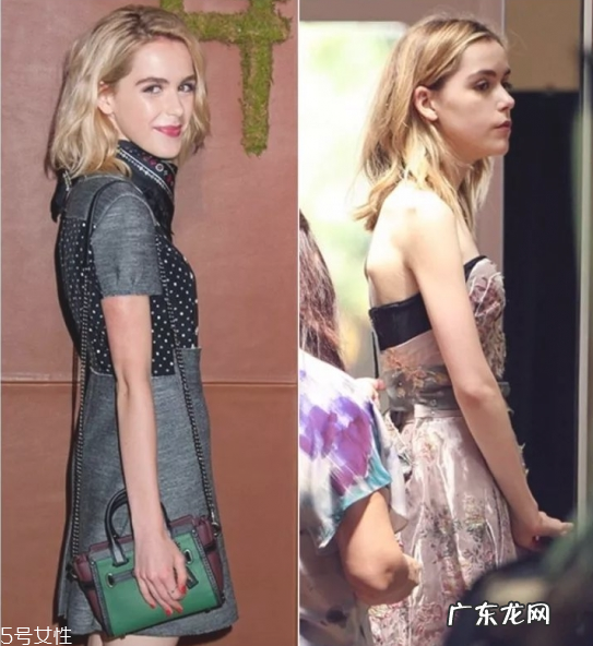 圆肩驼背怎么矫正 教你如何矫正圆肩驼背