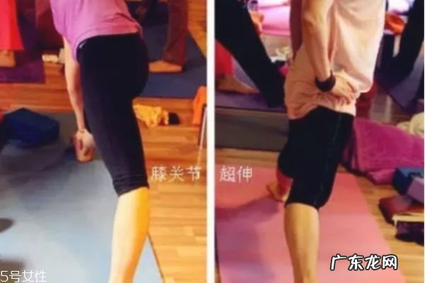 膝盖超伸怎么矫正 如何正确处理膝超伸