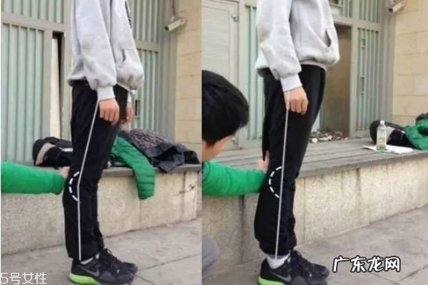 膝盖超伸怎么矫正 如何正确处理膝超伸