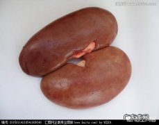 得了肾囊肿，应该注意什么