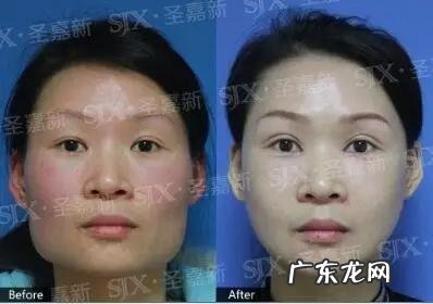 女孩子骨架大是种什么样的感受,如何判断自己是不是大骨架?