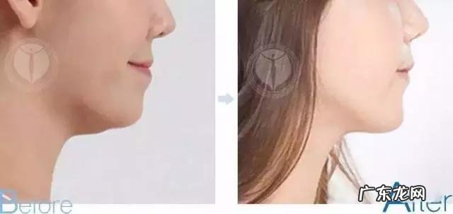 女孩子骨架大是种什么样的感受,如何判断自己是不是大骨架?