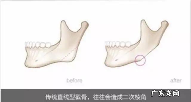 女孩子骨架大是种什么样的感受,如何判断自己是不是大骨架?