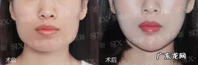 女孩子骨架大是种什么样的感受,如何判断自己是不是大骨架?