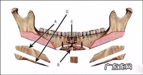 女孩子骨架大是种什么样的感受,如何判断自己是不是大骨架?