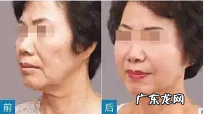 女孩子骨架大是种什么样的感受,如何判断自己是不是大骨架?