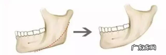 女孩子骨架大是种什么样的感受,如何判断自己是不是大骨架?