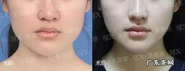 女孩子骨架大是种什么样的感受,如何判断自己是不是大骨架?