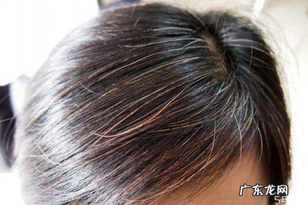 如何减少白头发 减少白头发的方法有什么