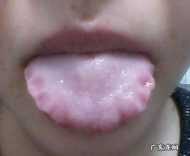 粪便粘马桶是湿气太重吗 排便沾马桶,是体内湿气重导致的吗?