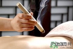 三伏灸可以吹电扇吗？三伏灸能不能吹电扇？