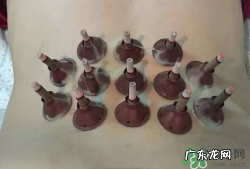 艾艾贴可以贴肚脐眼吗?艾艾贴贴肚脐有什么作用?