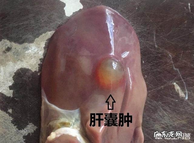 请问:多发性肝囊肿严重吗,需要注意什么