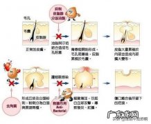 脸上的痘坑怎样淡化，希望真心回答